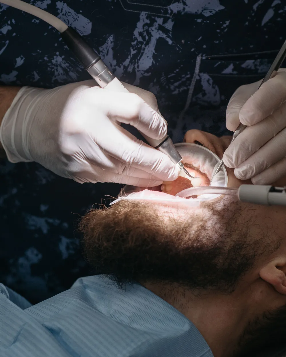Procedimiento dental en curso