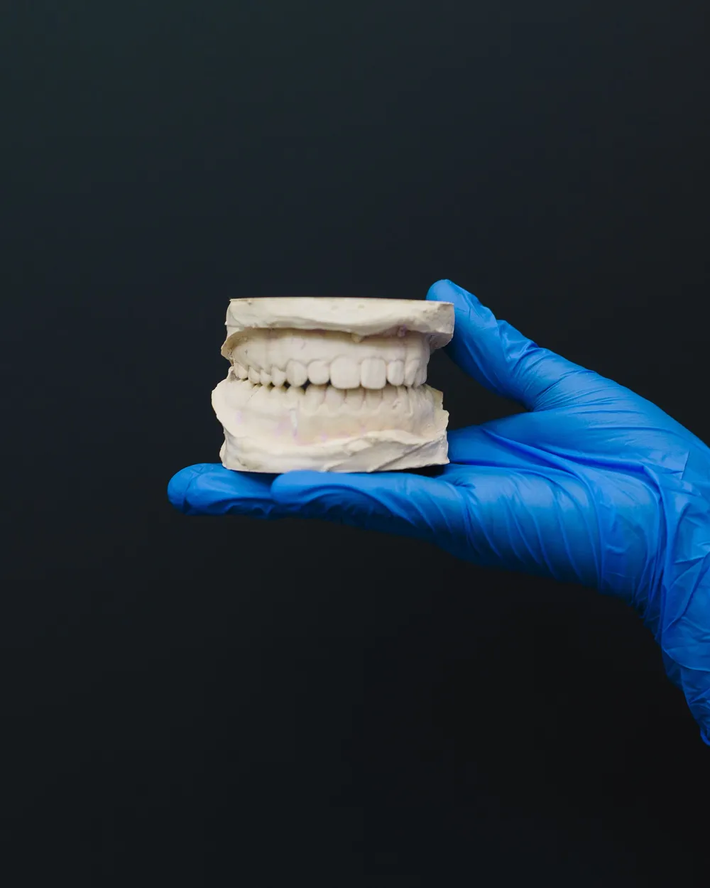 Modelo de prótesis dental hecha a medida